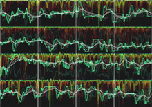Brainwaves taken from NeuroSky Mindset